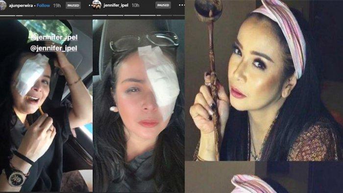 Istri Ajun Perwira, Jennifer Jill Supit terlihat matanya diperban.