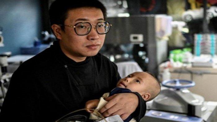 Xu wei dan anaknya yang menderita Sindrom Menkes