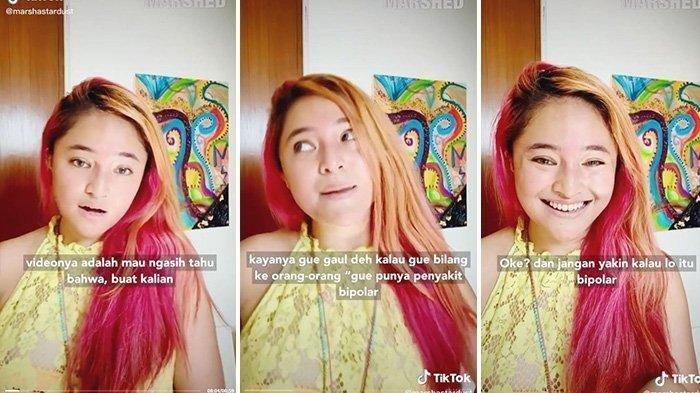 Marshanda curhat tentang bipolar