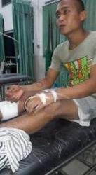 Buaya Terkam Kaki Agus Saat Banjir di Desanya