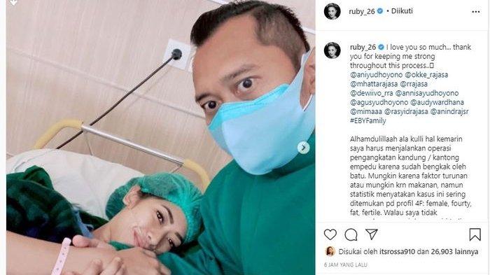 Aliya Rajasa jalani operasi pengangkatan kantong empedu