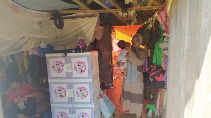 Yeni Febriansyah (2), balita asal Sesa Patih Selera, Kecamatan Belawang, Kabupaten Batola, didiagnosa menderita tumor jinak sejak lahir.