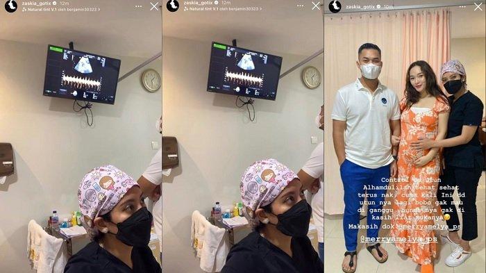 Zaskia Gotik cek kandungan ditemani Sirajuddin Mahmud. Begini kondisi kandungannya saat kontrol ke dokter.