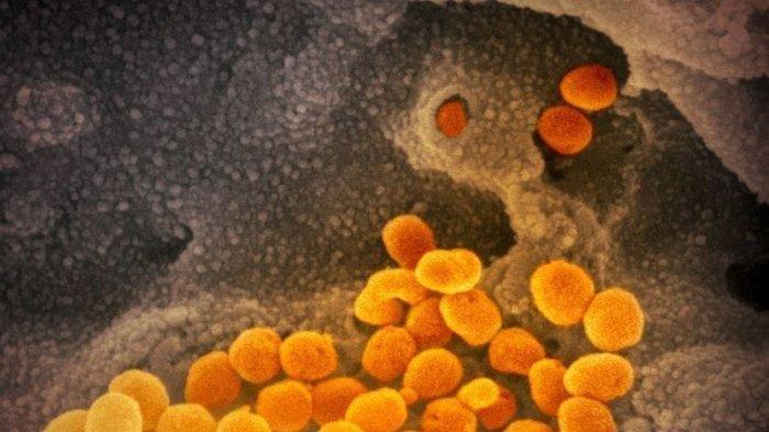 Bentuk virus Corona di mikroskop