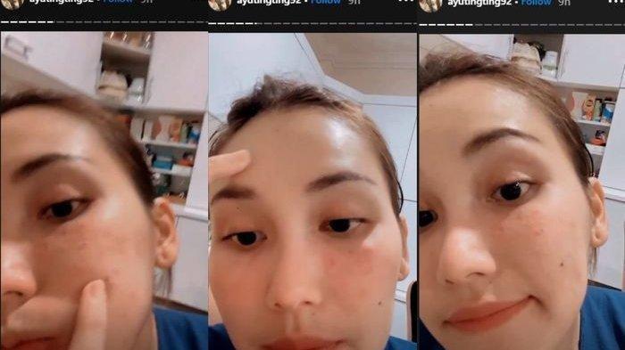 Wajah asli Ayu Ting Ting yang beruntusan dan ada beberapa flek hitam