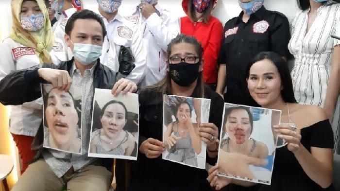 Adrena Isa Zega, eks manajer Lucinta Luna, gelar jumpa pers di kawasan Tebet, Jakarta Selatan, Senin (9/11/2020).