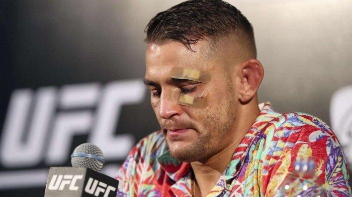 Dustin Poirier memberikan keterangan pers usai menjalani pertarungan