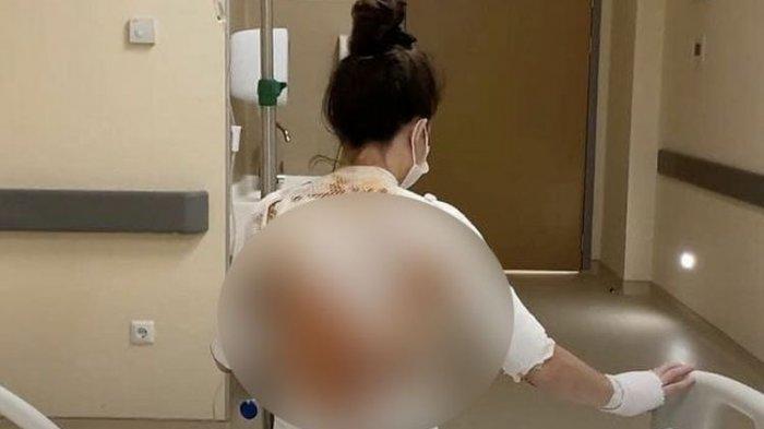 Rukiye Ay (23) punggungnya disiram air mendidih oleh suaminya, Ali Ay (28), yang marah karena dibangunkan untuk sarapan