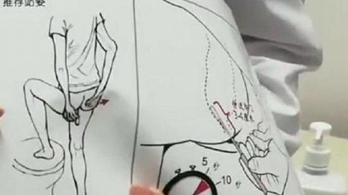 C memerlihatkan prosedur tes swab dengan sampel yang diambil dari anus. Baru-baru ini, AS mengeklaim diplomatnya dijadikan subyek pemeriksaan oleh China, klaim yang kemudian mendapat bantahan Beijing