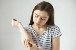 7 Obat Alami Hilangkan Gatal Biduran, Dijamin Ampuh!