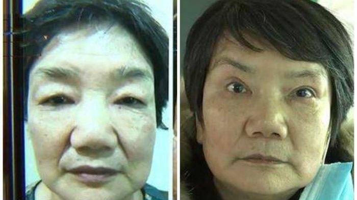 Nenek Shen diusir suaminya dari rumah setelah operasi plastik yang habiskan ratusan jutanya gagal total