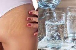 Benarkah Cuma Konsumsi Air Putih Bisa Hilangkan Stretch Mark, Simak Penjelasannya!