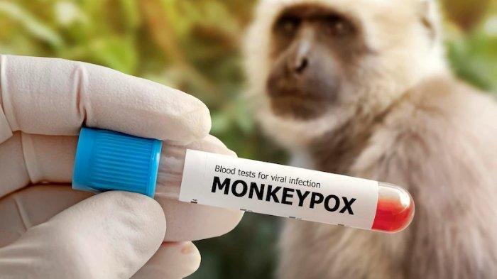 ilustrasi penyakit monkeypox atau cacar monyet disebut rentan menyerang kaum LGBT