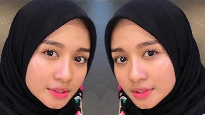 laudya cynthia bella