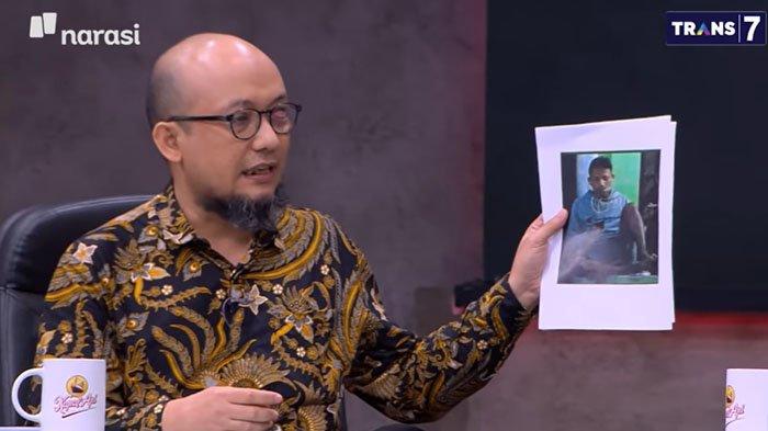 Novel Baswedan menunjukan foto seseorang yang mengawasi rumahnya