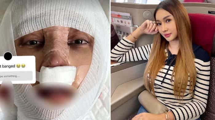 Lucinta Luna takut operasinya di Korea gagal