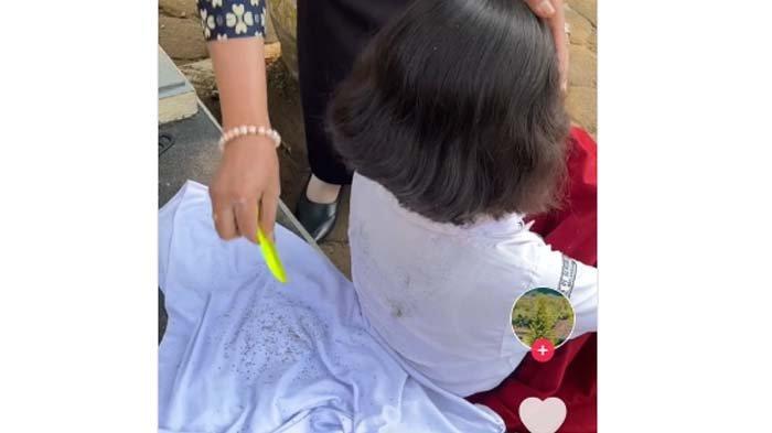 Video seorang bocah dengan rambut penuh kutu di kepalanya viral di media sosial. Video tersebut sampai mendapat perhatian dari Baim Wong
