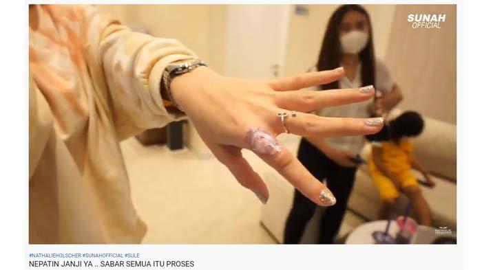 Jari tangan Nathalie Holscher berdarah usai dilaser