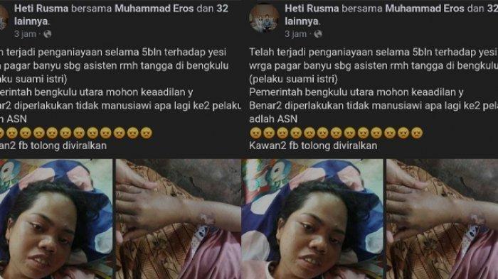 Akun media sosial Facebook @Heti Rusma mengunggah foto-foto ART di Kota Bengkulu yang diduga menjadi korban penganiayaan majikannya.
