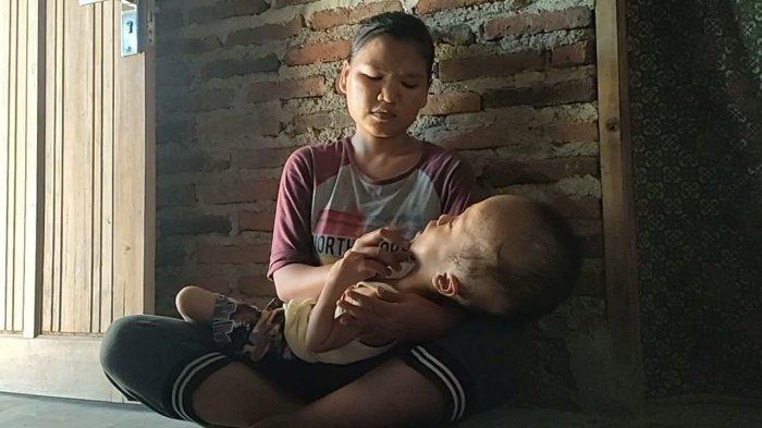 Mukhammad Ziban balita berusia 5 tahun di Desa Kaplongan Lor, Kecamatan Karangampel, Kabupaten Indramayu itu mengidap penyakit hidrosefalus atau pembesaran kepala, Jumat (3/9/2021).