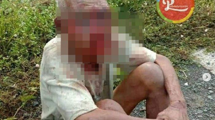 Kakek Basri, korban penganiayaan