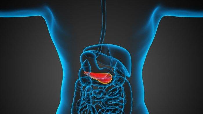 ilustrasi penyakit batu empedu, begini penjelasan Dokter Spesialis Penyakit Dalam Konsultan Gastroentero-Hepatologi, dr. Hasan Maulahela