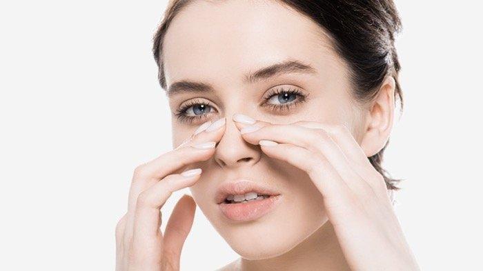 ilustrasi blackhead atau komedo hitam