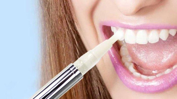 ilustrasi bleaching gigi, begini penjelasan Dokter Gigi, drg. R. Ngt. Anastasia Ririen Pramudyawati