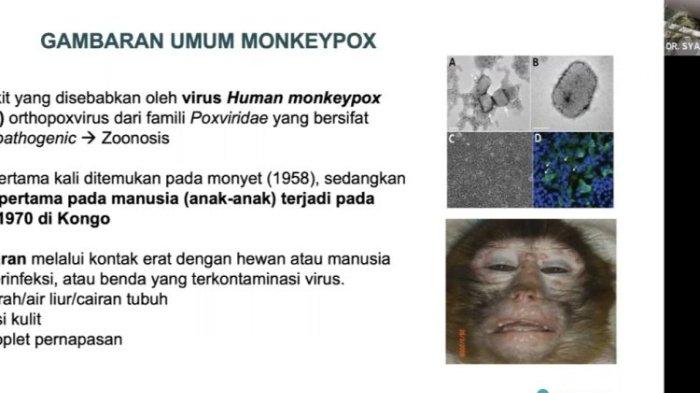 cacar monyet