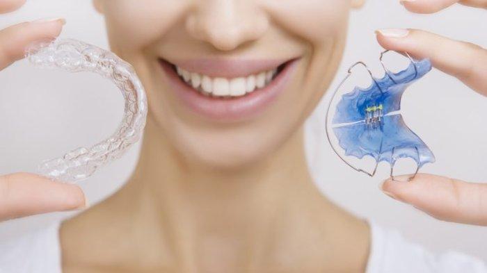 ilustrasi clear aligner dan retainer