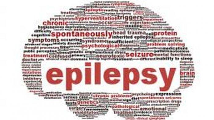 ilustrasi eplepsi