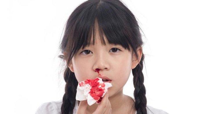ilustrasi anak dengan hemofilia