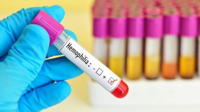 Ilustrasi Hemofilia