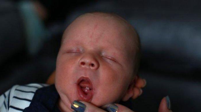 Ilustrasi bayi mengalami neonatal teeth, simak penuturan drg. R. Ngt. Anastasia Ririen Pramudyawati