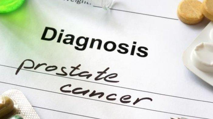 Ilustrasi diagnosis kanker prostat