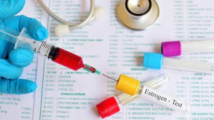 Ilustrasi estrogen replacement therapy, simak penuturan dr. Binsar Martin Sinaga, FIAS