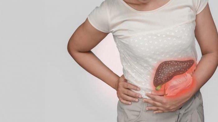 Ilustrasi gejala penyakit liver yang biasanya dirasakan, begini kata dr. Mustopa, Sp.PD