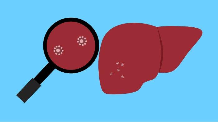 Ilustrasi - hati/liver