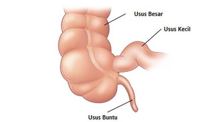 Ilustrasi letak usus buntu
