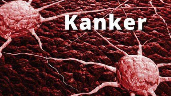 Ilustrasi penyakit kanker ganas