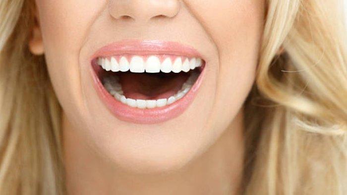 Ilustrasi tertawa terlalu lebar, begini kata Dokter Gigi Spesialis Orthodonsia, drg. Ardiansyah S. Pawinru, Sp. Ort (K)