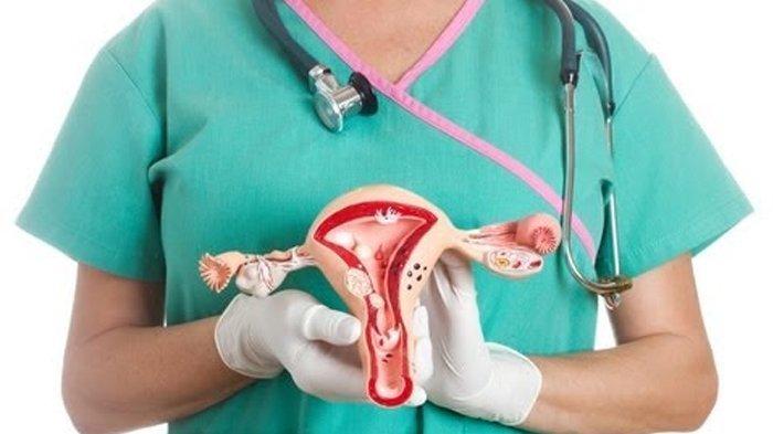 ilustrasi kanker serviks, begini penuturan dr. G. Iranita Dyantika