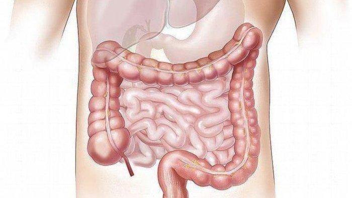 Ilustrasi usus