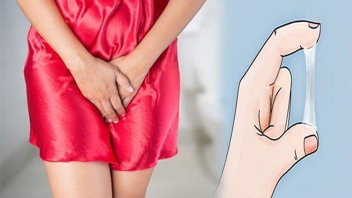 ilustrasi wanita yang mengalami keputihan