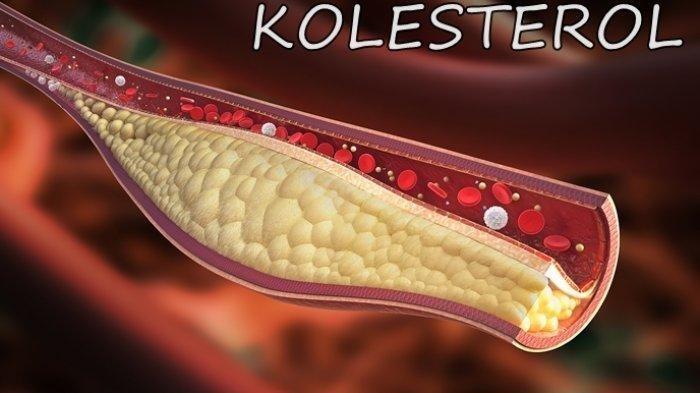 ilustrasi kolesterol