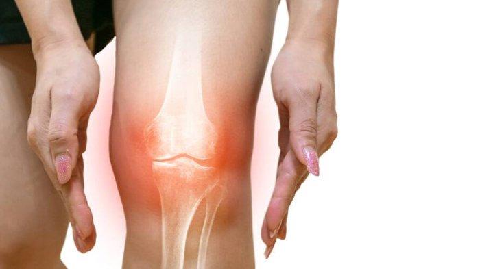 Ilustrasi osteoarthritis