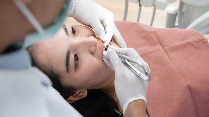 ilustrasi proses pemasangan clean aligner