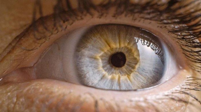 ilustrasi retina mata lepas