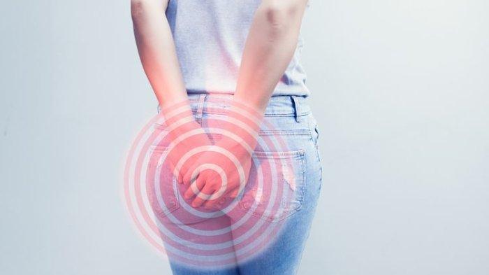 Ilustrasi terkena kanker anus