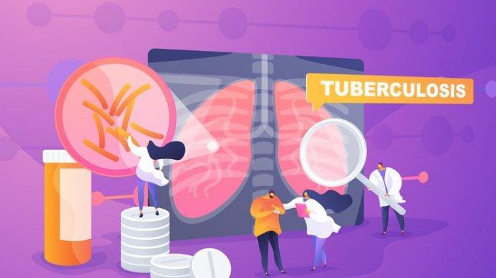 Ilustrasi penyakit TBC